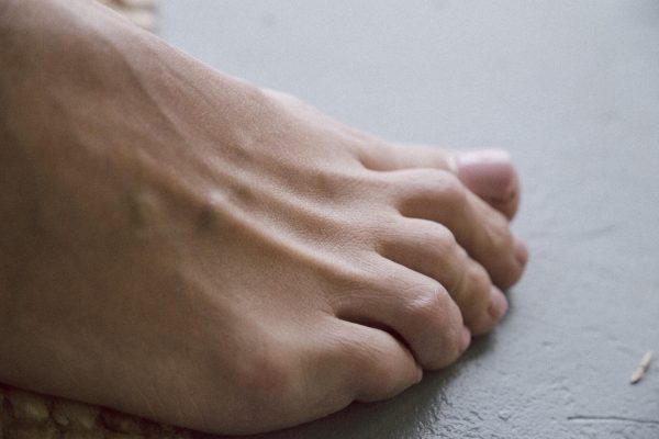 Early Signs of Arthritis in the Feet 